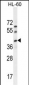 C17orf59 Antibody (Center)
